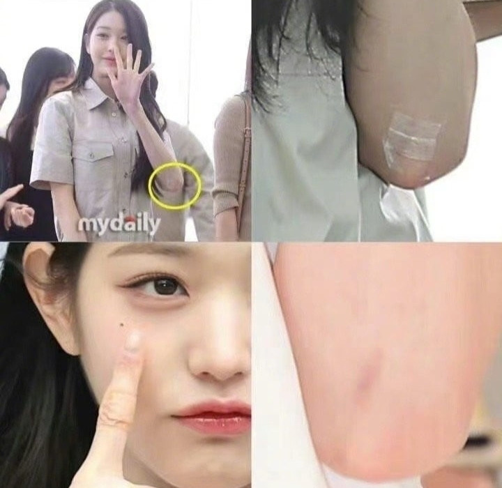foto siku tangan wonyoung nenarik perhatian