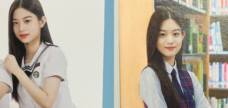 minju illit operasi plastik